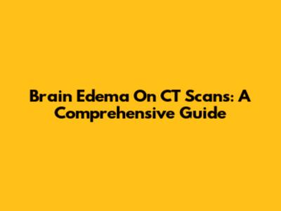 Brain Edema On CT Scans: A Comprehensive Guide