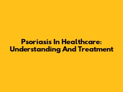 Psoriasis In Healthcare: Understanding And Treatment