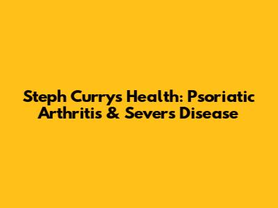 Steph Curry's Health: Psoriatic Arthritis & Sever's Disease
