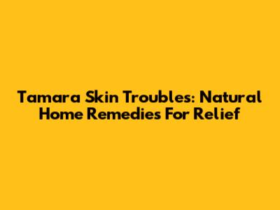 Tamara Skin Troubles: Natural Home Remedies For Relief
